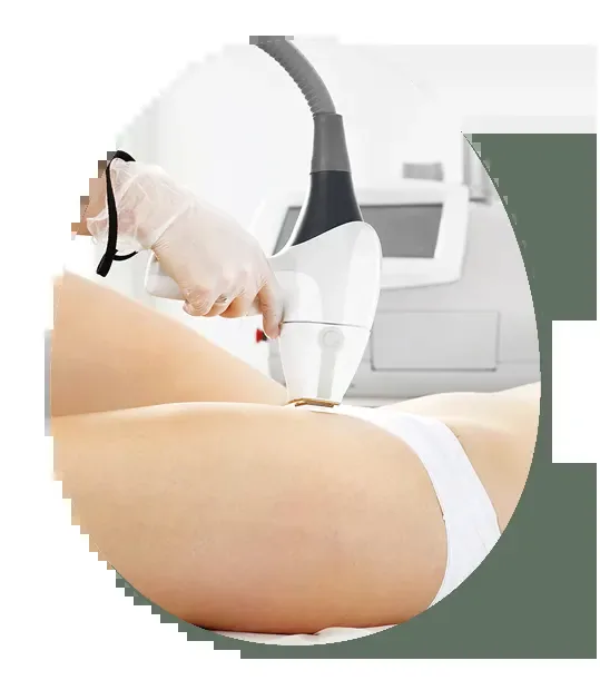 Laser Hair Removal at Desert Rain Skin