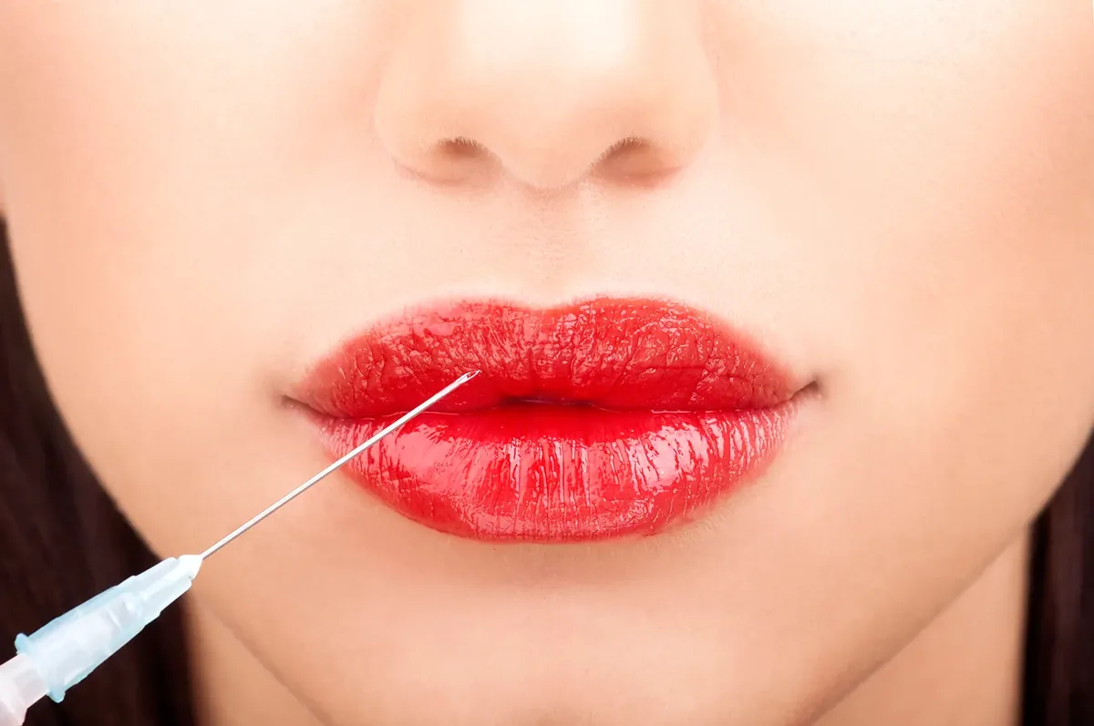 Lip Fillers at Desert Rain Skin