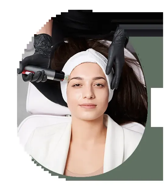 Microneedling at Desert Rain Skin